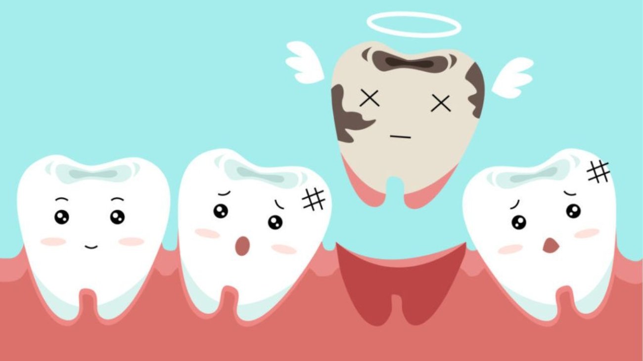 Tooth loss is more than a cosmetic issue