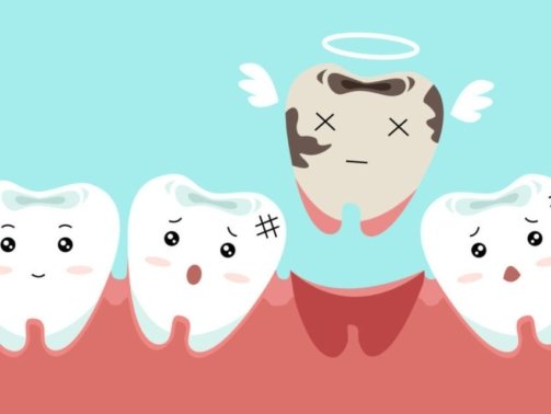 Tooth loss is more than a cosmetic issue